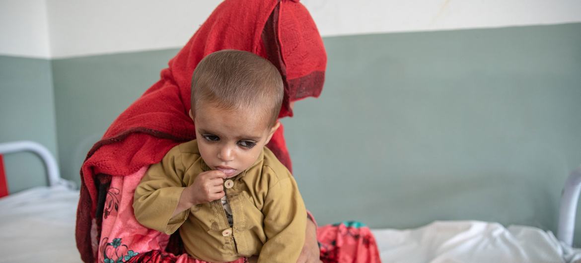 یک مادر و پسر دو ساله اش به دلیل سوءتغذیه در شفاخانه ای در ولایت کنر افغانستان تحت معالجه هستند.